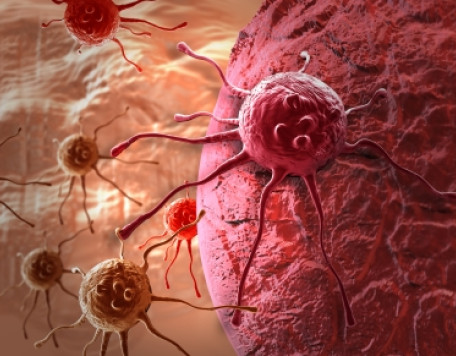 cancer cell fkWjSOu 