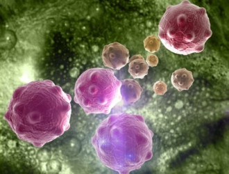 Body 29 Cancer Cells