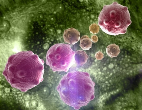 Body 29 Cancer Cells
