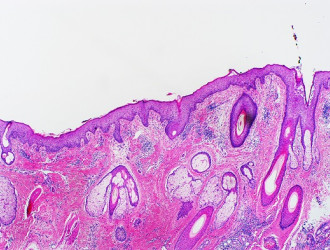 h e stain light microscopy normal skin of scalp 2024 10 18 17 40 36 utc