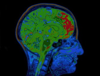 Mind 30 Head Scan