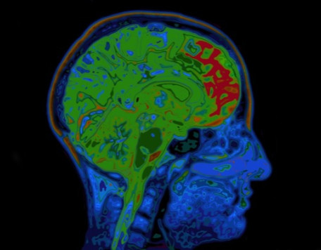 Mind 30 Head Scan