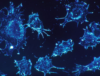 cancer cells 541954 1920 1 1