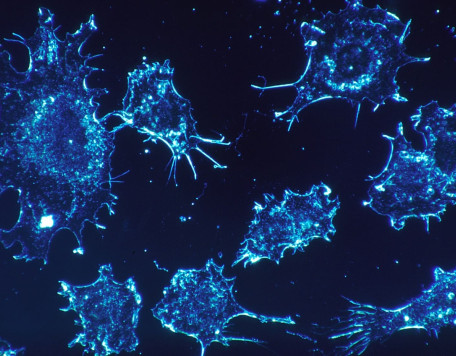cancer cells 541954 1920 1 1